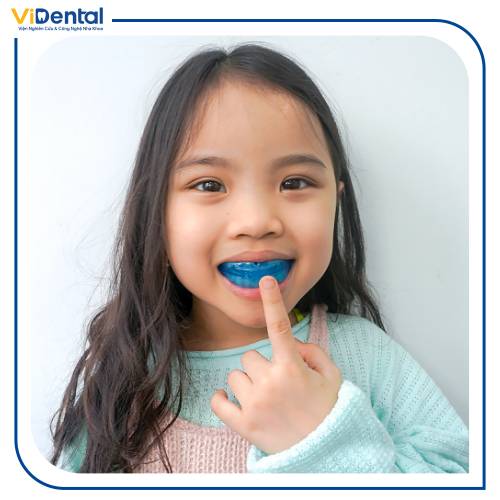Có nên niềng răng cho trẻ 7 tuổi không là thắc mắc của rất nhiều phụ huynh hiện nay