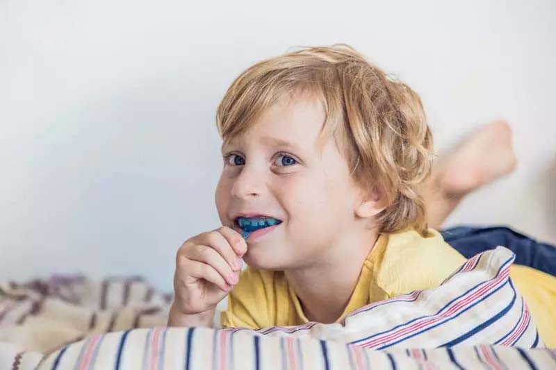 Niềng răng silicon cho trẻ em là phương pháp khá phổ biến