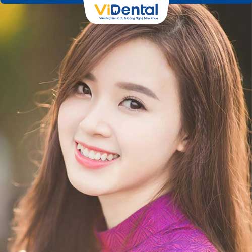 Răng khểnh được xem là nét đẹp đặc trưng của người Á Đông