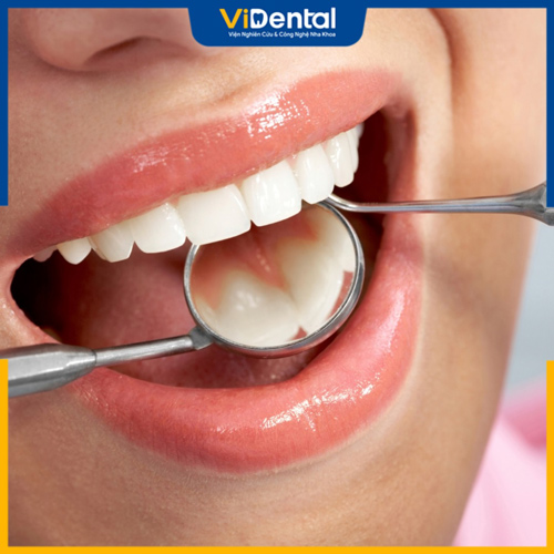 Bệnh nhân sẽ được phục hình răng đẹp và khỏe mạnh hơn