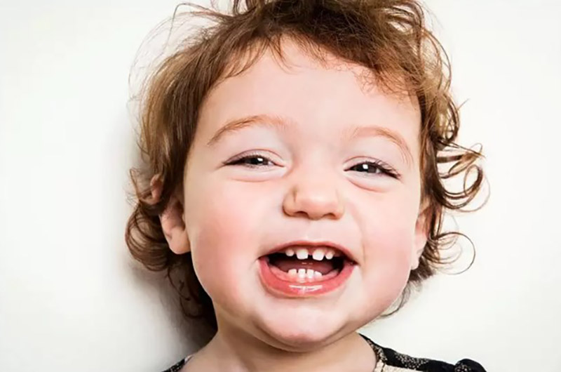 Răng sữa mọc thưa là tình trạng xảy ra ở khá nhiều bé