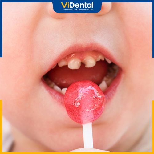 Nguyên nhân dẫn đến tình trạng sâu răng trẻ em là do ăn đồ ngọt