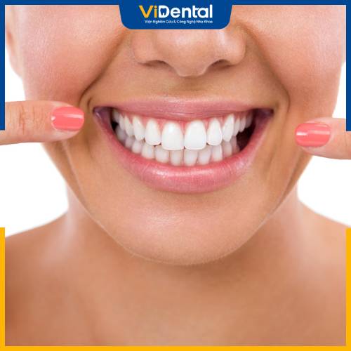 Việc niềng răng có thể kéo dài trong khoảng từ 18 - 25 tháng