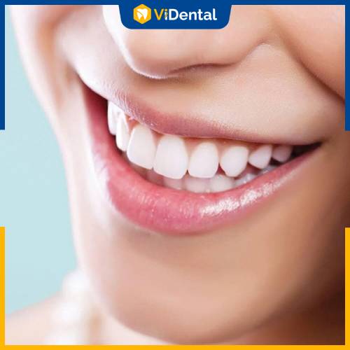 Bọc răng sứ giúp mang đến cho bạn hàm răng trắng đẹp hơn