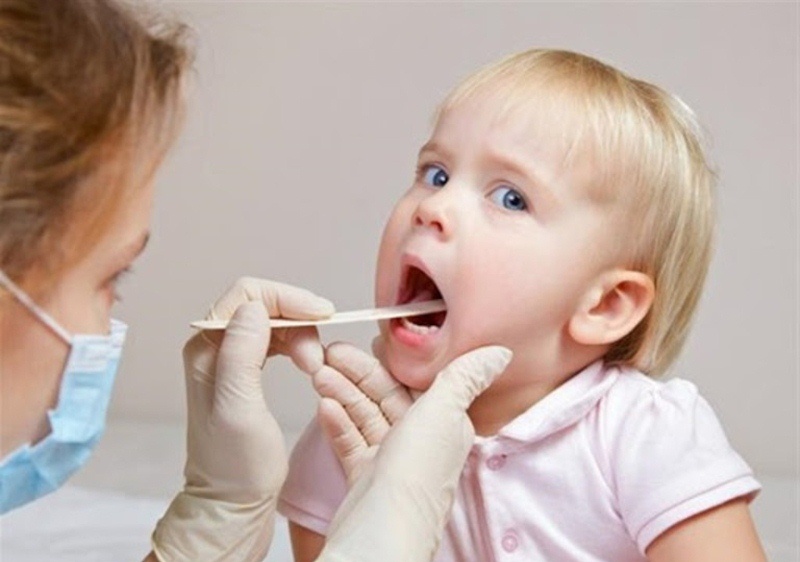Nếu không điều trị kịp thời, viêm nướu răng sẽ gây nhiều biến chứng