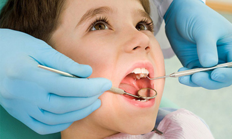 Lấy cao răng là cách khắc phục hiện tượng tụt nướu mức độ nhẹ