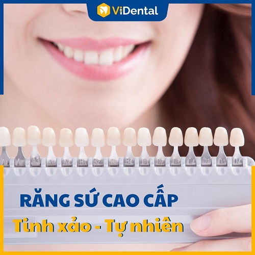 Chất liệu răng sứ cao cấp, đảm bảo an toàn và hiệu quả tối đa chỉ có tại ViDental Clinic
