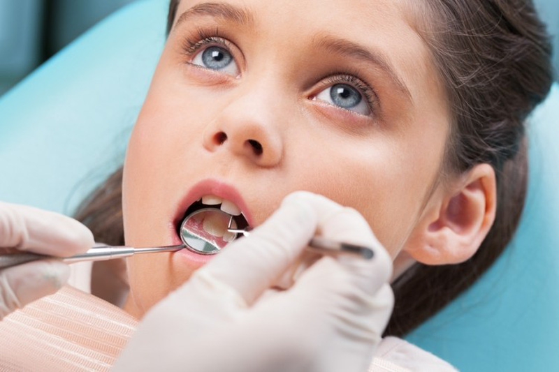 Hàn răng giúp ngăn chăn sâu răng phát triển