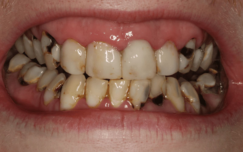 Hình ảnh Vẽ Tay Răng Hoạt Hình Răng Tình Yêu Răng Ngày Dễ Thương Minh Họa  Răng Cười PNG  Răng Hàm Răng Khỏe Bảo Vệ Răng PNG miễn phí tải tập