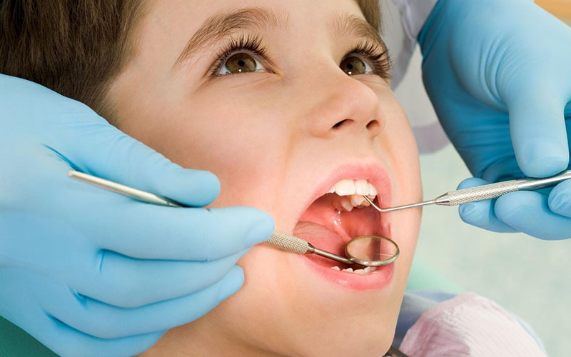 Nhổ răng sẽ được chỉ định nếu trẻ bị sâu răng số 6 mức độ nặng