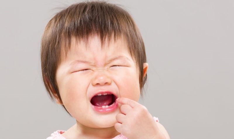 Chăm sóc răng miệng không đúng cách là nguyên nhân khiến trẻ bị sâu răng sưng má