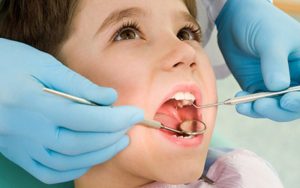 Chuyên Gia Giải Đáp Trẻ Em Có Nên Lấy Cao Răng Không?