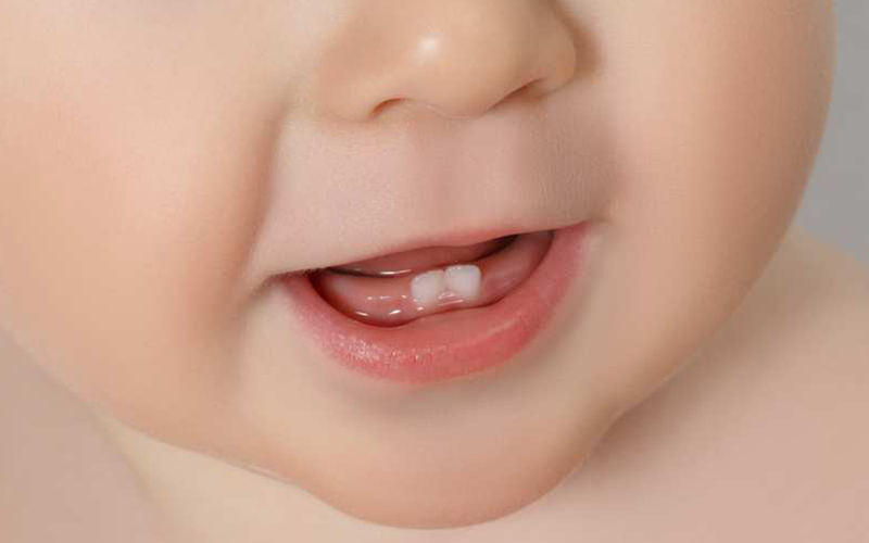 Trẻ mọc răng sớm không ảnh hưởng tới sự phát triển nói chung
