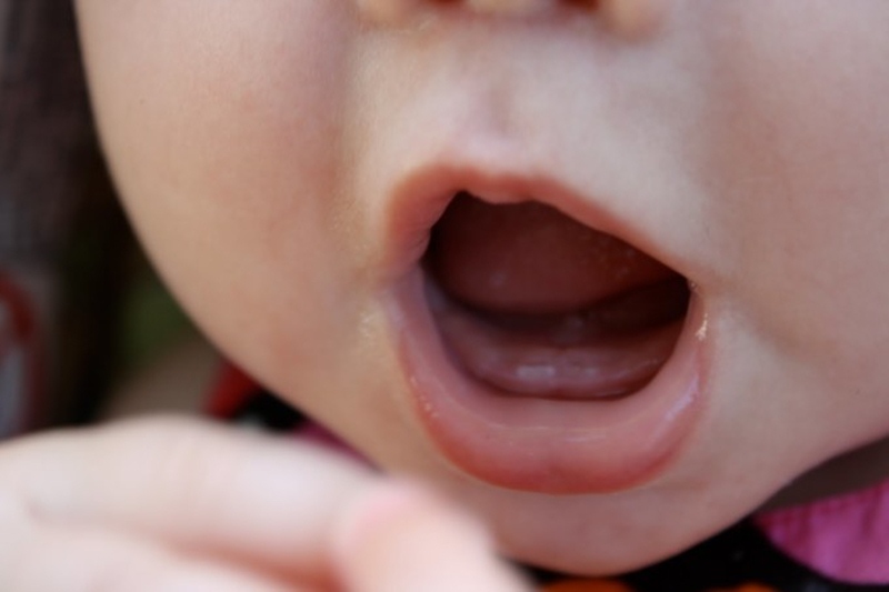 Trẻ 2 tháng mọc răng được coi là mọc răng sớm