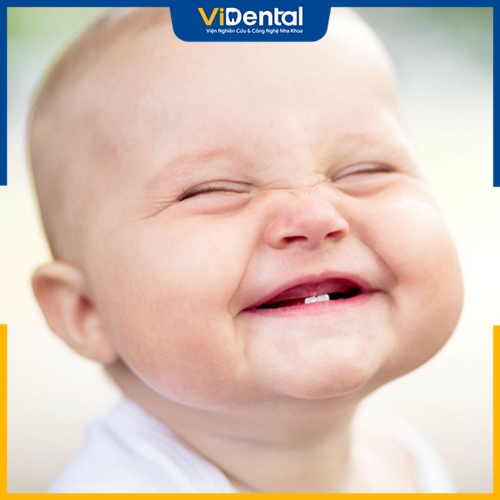 Mọc răng chậm là một dấu hiệu cho thấy trẻ mọc răng bất thường