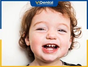 Trẻ mới mọc răng đã bị đen do nhiều nguyên nhân gây ra