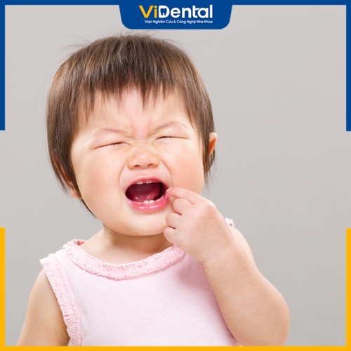 Nhiều nguyên nhân có thể khiến trẻ mọc răng chậm