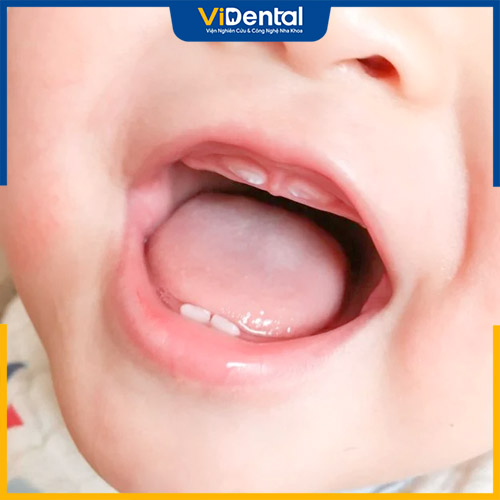 Đi tướt mọc răng là hiện tượng bé đi ngoài nhiều lần khi mọc răng