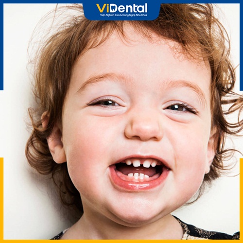 Thứ tự thay răng cũng tương tự như khi mọc răng sữa. Răng mọc trước thường sẽ rụng trước. 
