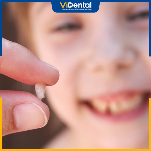 Làm thế nào để răng bé mọc đều là vấn đề quan tâm của mọi cha mẹ