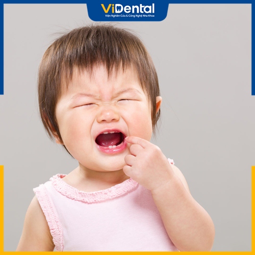  Di truyền là một trong những nguyên nhân khiến trẻ chậm mọc răng