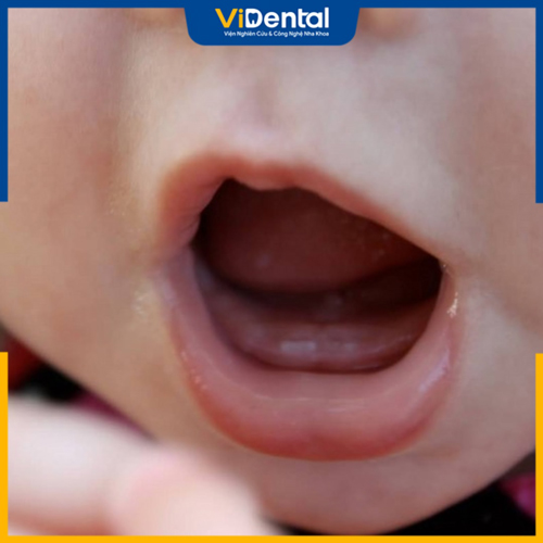 Thông thường chiếc răng đầu tiên của trẻ mọc vào tháng tuổi thứ 6