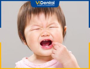 [Giải Đáp Bạn Đọc] Trẻ Mọc Nhiều Răng Cùng Lúc Có Sao Không?