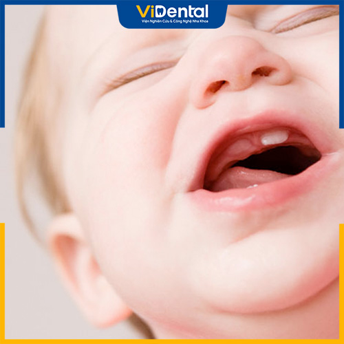 Trẻ mọc răng sốt mấy ngày là câu hỏi của không ít bậc phụ huynh