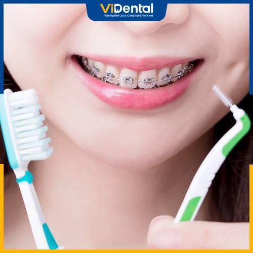 Hướng dẫn trẻ vệ sinh răng miệng sau niềng giúp răng khỏe mạnh và tăng hiệu quả niềng răng