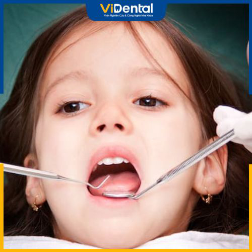 ViDental Kid - Địa chỉ khám, điều trị cho bé 3 tuổi bị sâu răng hiệu quả