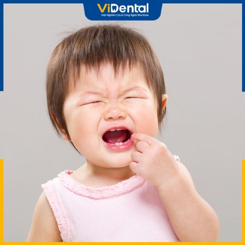 Trong quá trình phát triển răng trẻ cần được bổ sung đủ dinh dưỡng