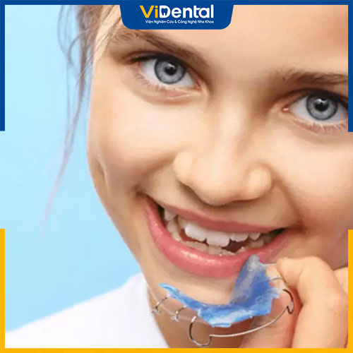 Vidental có đa dạng các hình thức niềng răng cho trẻ em 11 tuổi