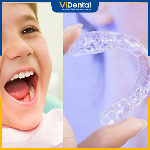 Máng niềng răng trong suốt Invisalign First