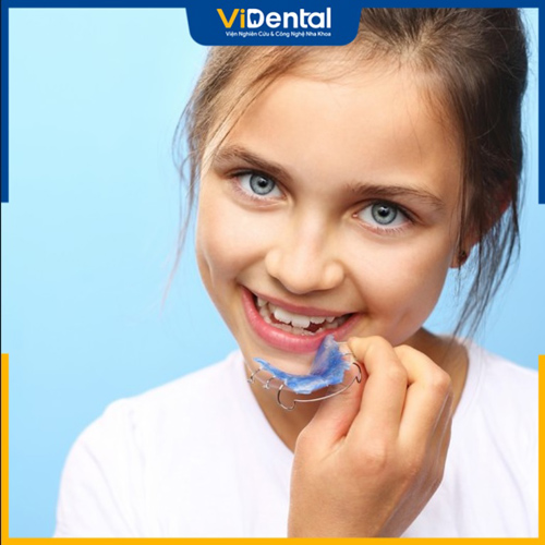 Niềng răng trẻ em mang lại hiệu quả cao và tiết kiệm thời gian