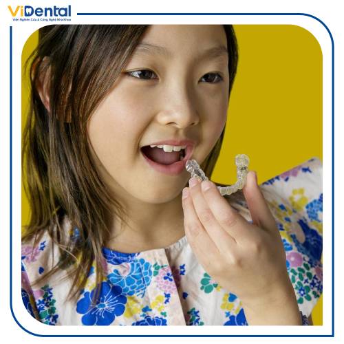 Niềng răng Invisalign cho trẻ có chi phí đắt hơn, nhưng mang đến nhiều ưu điểm và hiệu quả vượt trội