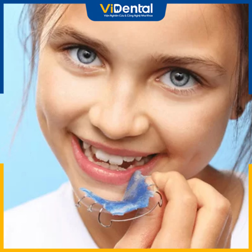 Khí cụ nong hàm có nền nhựa hạn chế áp lực lên răng
