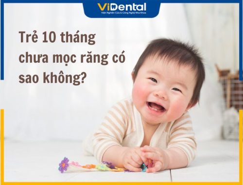 Trẻ 10 Tháng Chưa Mọc Răng Có Sao Không? Cần Phải Làm Gì?