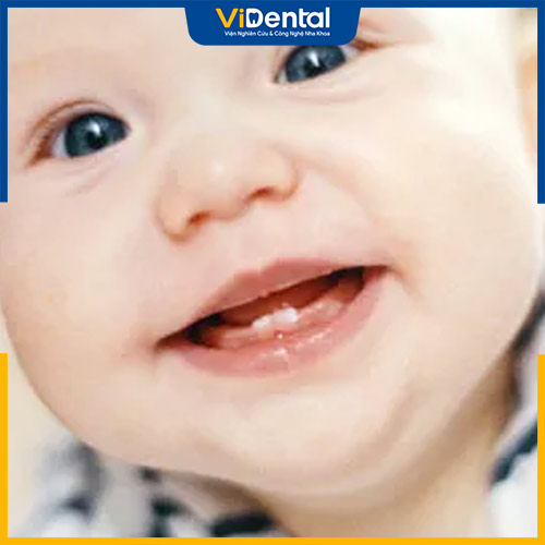 Trẻ có thể mọc răng không theo lịch trình cố định