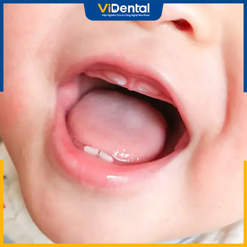 Ba mẹ có thể áp dụng một số mẹo để kích thích mọc răng cho con