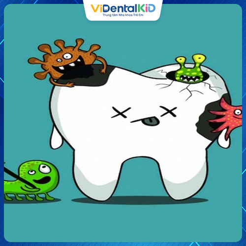 Nguyên nhân gây bệnh chính là do vi khuẩn tấn công men răng