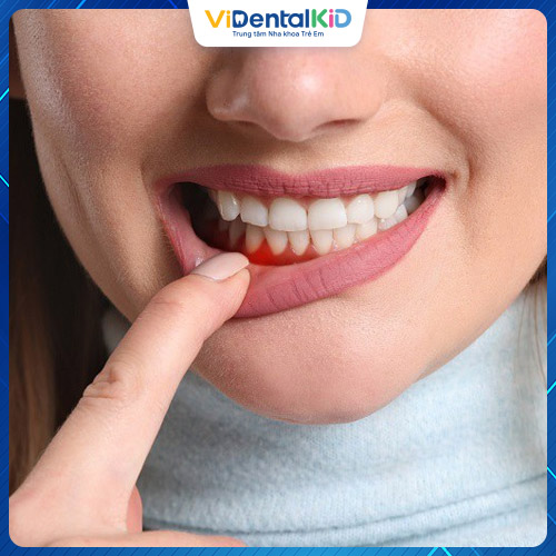 Trước khi bọc răng sứ bạn cần phải điều trị khỏi các bệnh nha chu