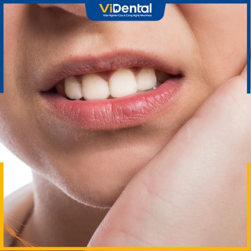 Triệu chứng của viêm tủy răng điển hình là đau nhức răng