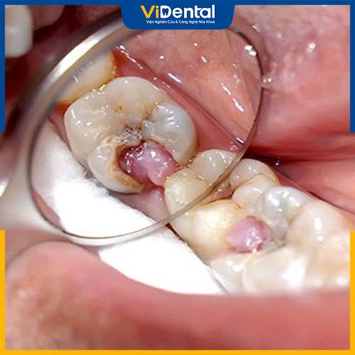 Trong trường hợp răng có dấu hiệu đau nhức bất thường, bạn nên đến các cơ sở nha khoa để kiểm tra