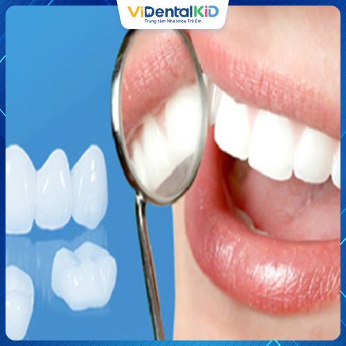 Số lượng răng cần bọc sứ ảnh hưởng trực tiếp đến thời gian hoàn thành