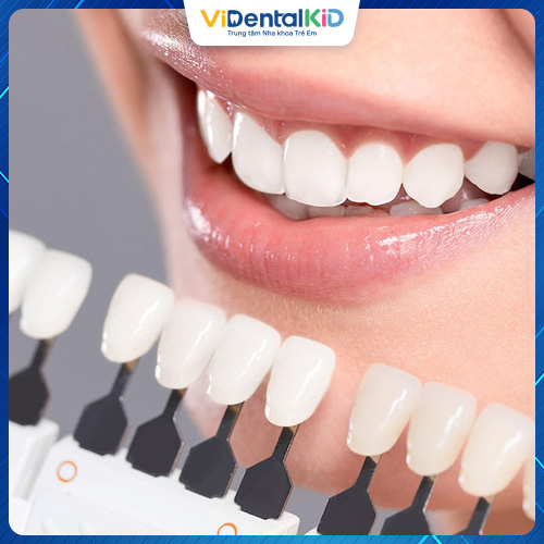 Bọc răng sứ là một dịch vụ nha khoa thẩm mỹ phổ biến hiện nay