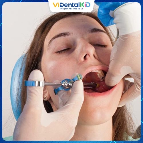 Trồng răng hàm có sự hỗ trợ của thuốc tê, hạn chế đau nhức