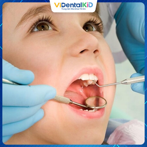 Điều trị viêm tủy răng tại nha khoa an toàn, hiệu quả cao