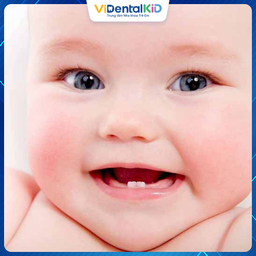 Răng sữa ở trẻ là những chiếc răng mọc đầu tiên trong thời kỳ trẻ bú mẹ