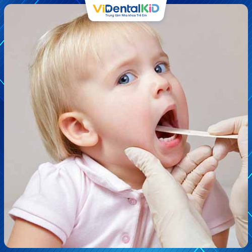 Nên cho trẻ đến gặp bác sĩ để quá trình nhổ răng sữa đảm bảo an toàn