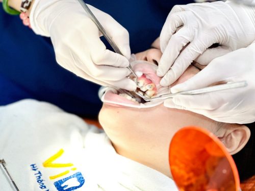 Tình trạng răng miệng ảnh hưởng đến chi phí niềng răng